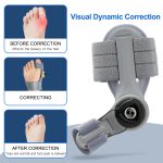 Bunion Corrector Unisex Foot Hallux Valgus Braces Rotatable Toe Separator Pedicure - Image 5