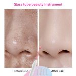 4 in1 Portable High Frequency Facial Wand - Image 6