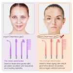 4 in1 Portable High Frequency Facial Wand - Image 9